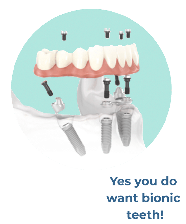 Yes you do want bionic teeth!