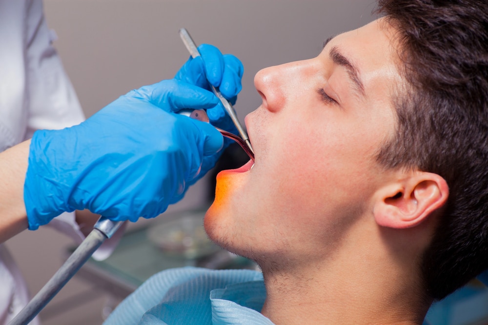 4 Factors To Consider When Getting All-On-4 Dental Implants